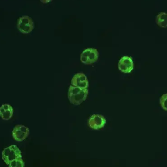 Perinuclear Anti-Neutrophil Cytoplasmic Antibodies (P-ANCA) test